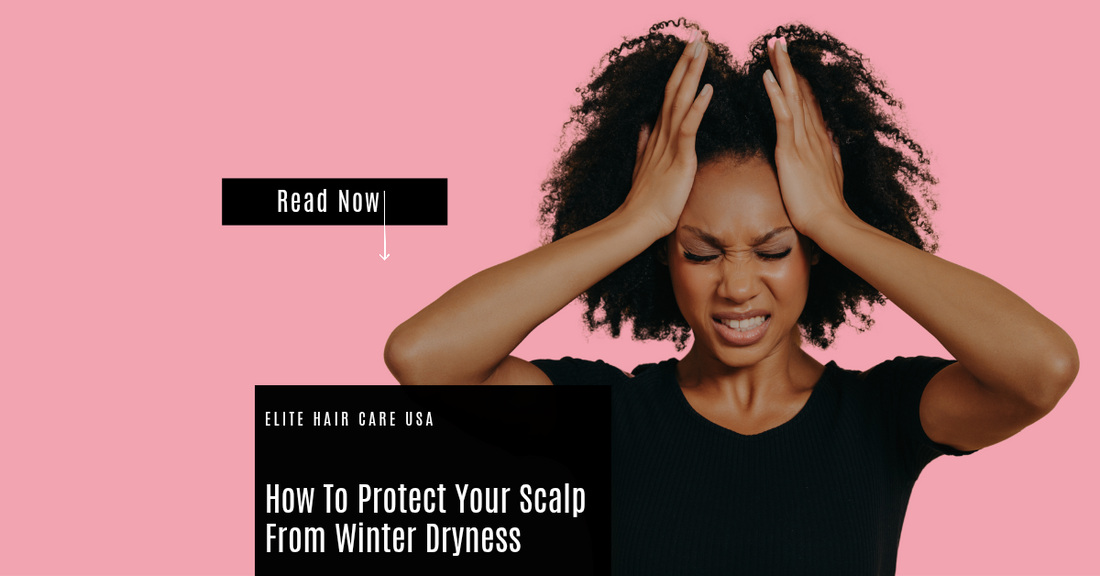 How To Protect Your Scalp From Winter Dryness